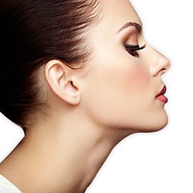 Rhinoplasty