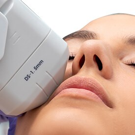 Laser and Ultherapy Treatments
